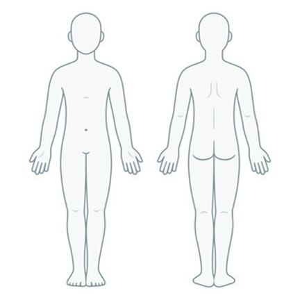 Front and back body chart with clickable areas