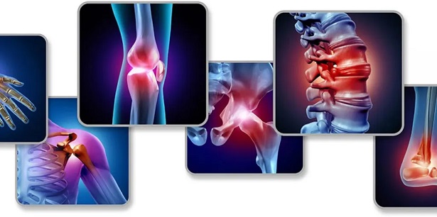 rheumatology-image